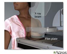 mammography compression testing|breast pain months after mammogram.